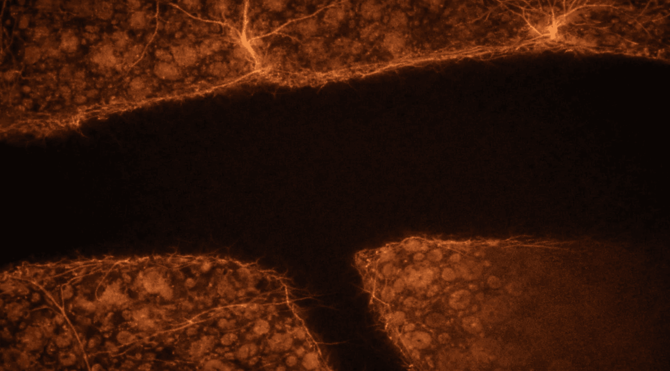 Blood brain barriers